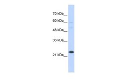 TAF12 Antibody, Novus Biologicals 100 &mu;L; Unconjugated:Antibodies, Polyclonal